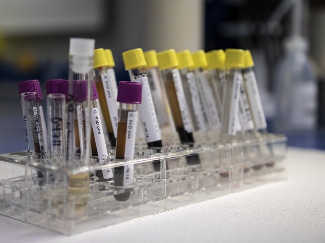 Blockchain benefits in blood transfusion